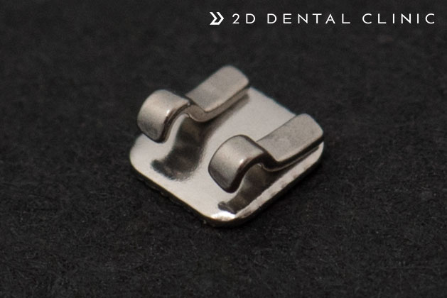 앞니 부분교정 전체교정 비교, 강남 2D치과 관련 이미지 5