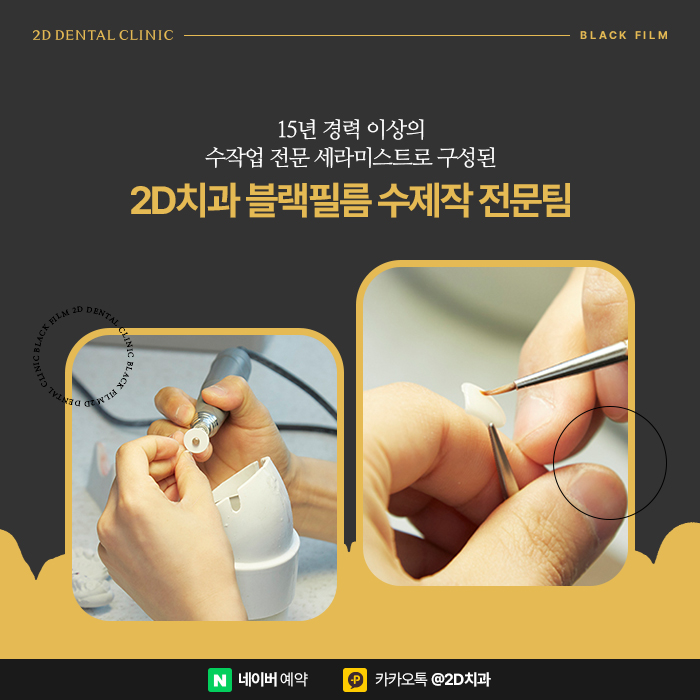 무삭제라미네이트 <블랙필름> 신논현역 투디치과 관련 이미지 2