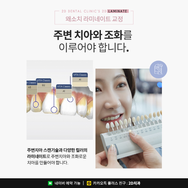 유난히 작은 치아 개선은? 2D 왜소치 라미네이트 교정 관련 이미지 4