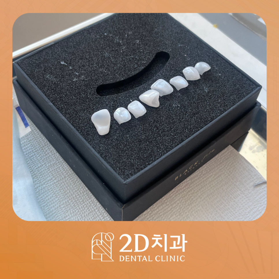부산무삭제라미네이트 영구치앞니깨짐 어떻게 해야 좋을까요? 관련 이미지 2