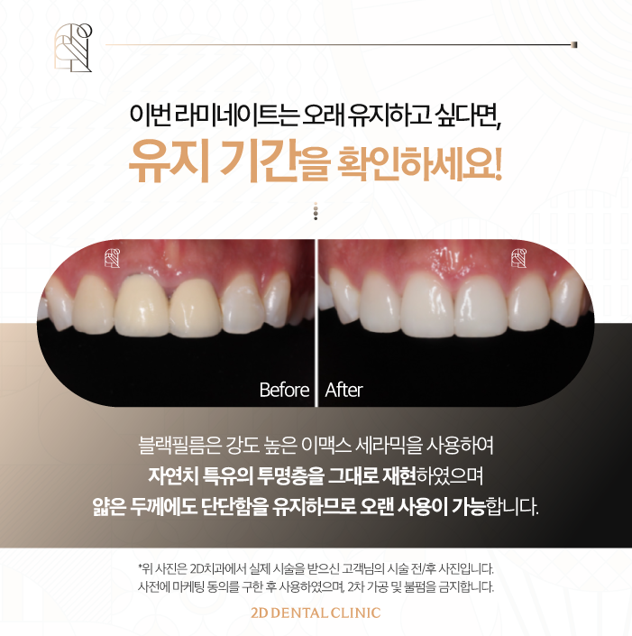 무삭제라미네이트비용 라미네이트 교체도 문제없어요 관련 이미지 6