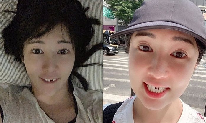 라미네이트 빠짐 대처법 관련 이미지 1