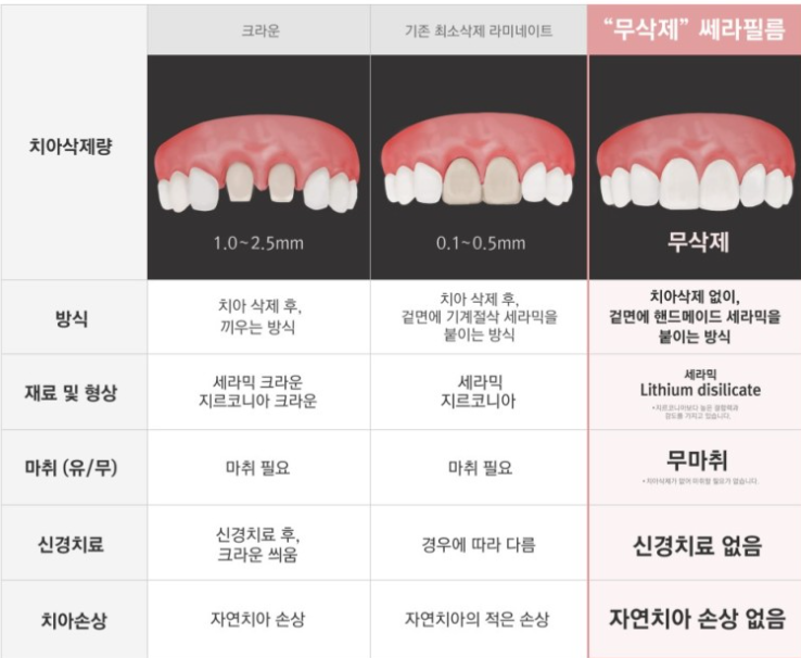 치아성형 잇몸성형 치아삭제 없는 무삭제라미네이트 블랙필름 관련 이미지 10