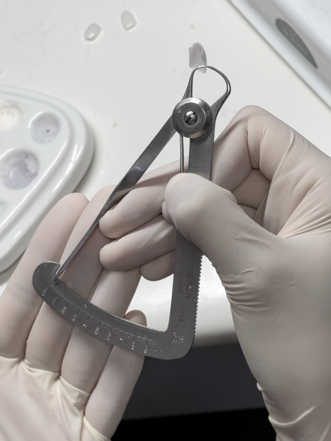 앞니치아마모증 무삭제라미네이트 블랙필름으로 치아고민해결 관련 이미지 8