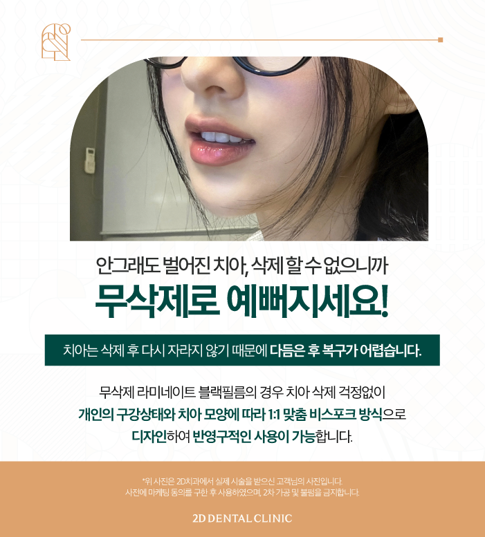 강남무삭제라미네이트 신논현역치과 블랙필름 벌어진 앞니도 걱정 없이! 관련 이미지 6