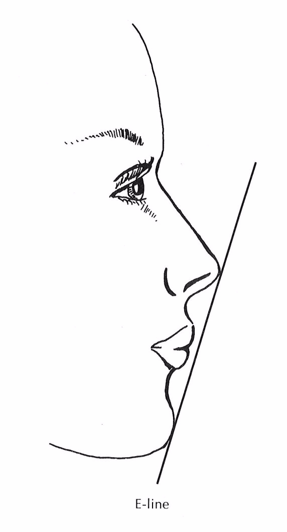 돌출입 유형 및 증상, 치과 내원 전 자가진단! 관련 이미지 3