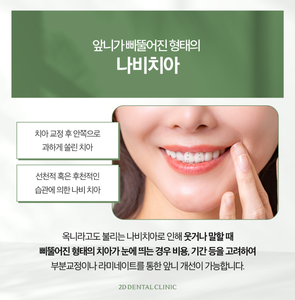 전주무삭제라미네이트 나비치아 안으로 쏠린 앞니도 반듯하게 관련 이미지 3