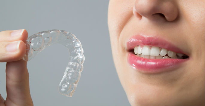 치아 교정 만큼 중요한 사후관리, 유지 장치 관련 이미지 9