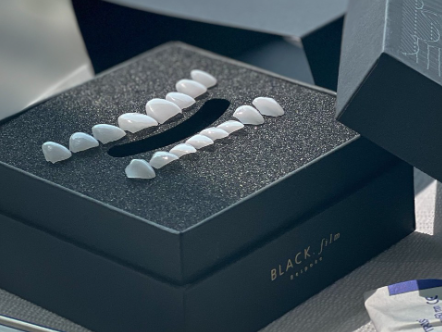 무삭제라미네이트후기 치아삭제없는 블랙필름 관련 이미지 11