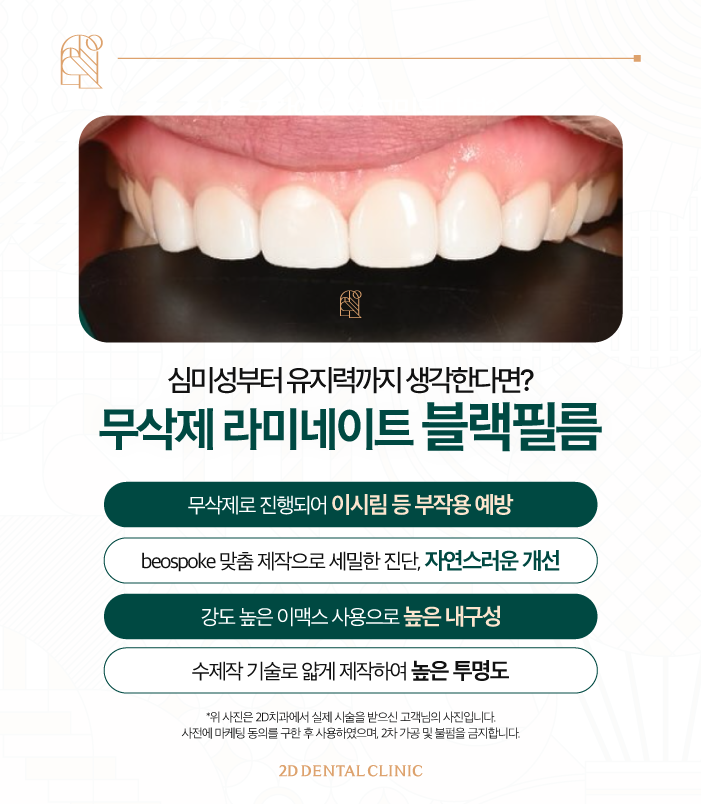 강남무삭제라미네이트 신논현역치과 블랙필름 벌어진 앞니도 걱정 없이! 관련 이미지 5