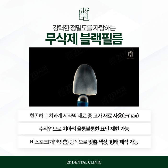 자연스러운 앞니라미네이트를 위한 방법 관련 이미지 4