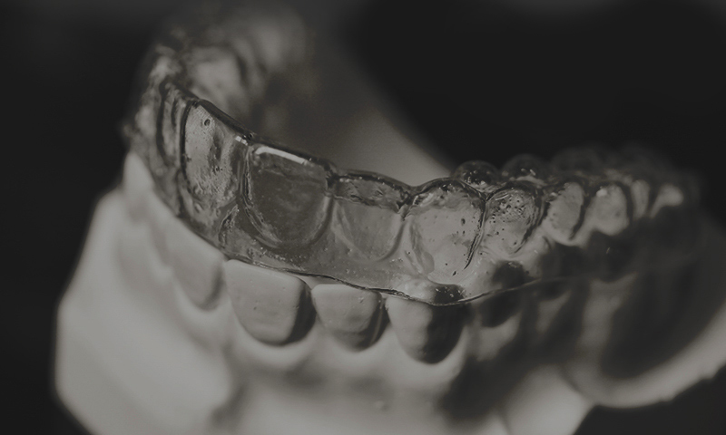 와,앞니 부분교정?!이라고?! 관련 이미지 9