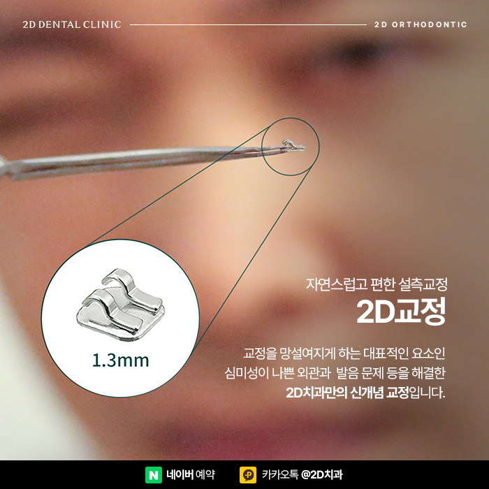 효과적인 설측교정을 위한 정보, 신논현 교정전문의치과 관련 이미지 5