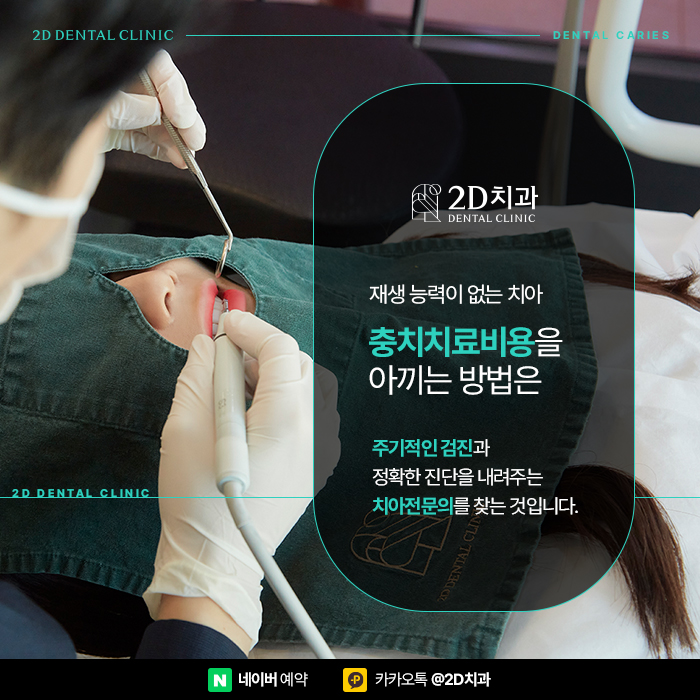 충치치료비용 아끼는 방법, 신논현 충치치료 잘하는 곳 관련 이미지 3