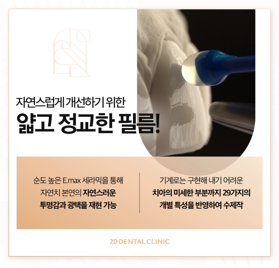 치아무삭제라미네이트 치아성형 연예인처럼 가지런한 앞니 관련 이미지 4