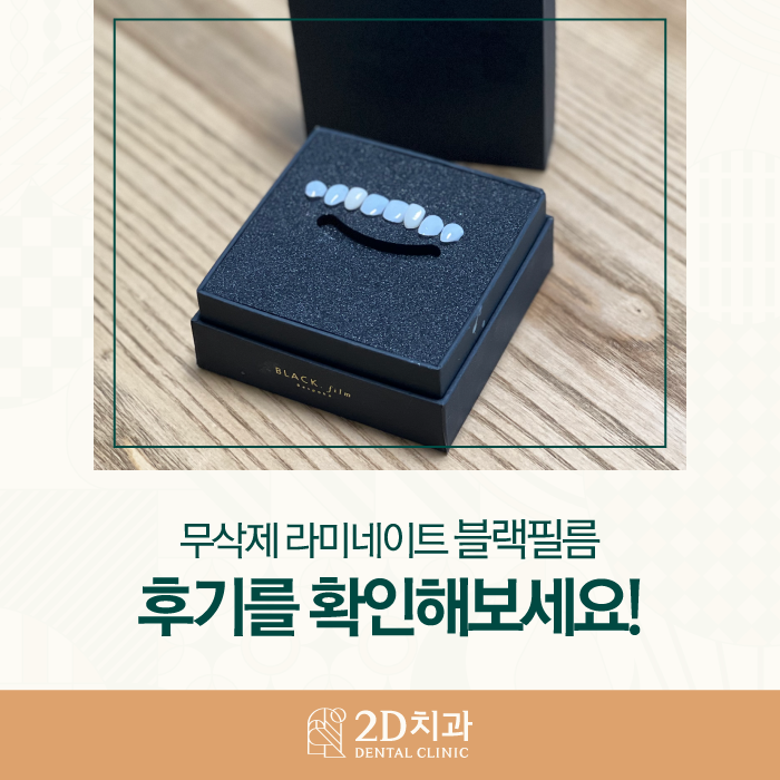 앞니 무삭제라미네이트가격, 후기 부작용 걱정 없이 받아보자! 관련 이미지 1