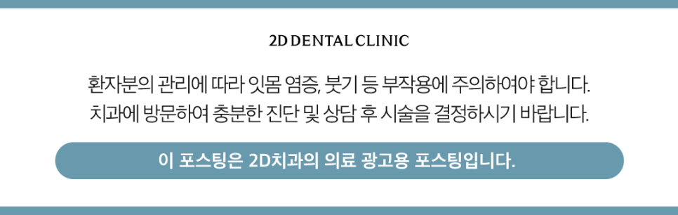치과라미네이트 치아성형 이 손상 줄이고 심미성 높이고 관련 이미지 13