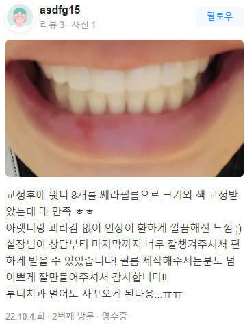 무삭제라미네이트 후기 모음 관련 이미지 13