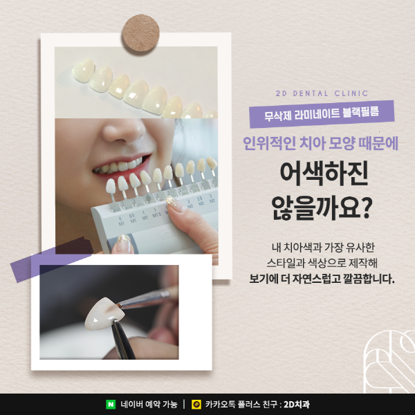 앞니 라미네이트 블랙필름의 효과성 A to Z 관련 이미지 5