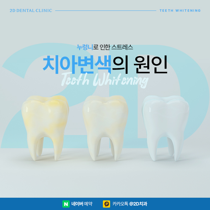 누렁니 원인 치아변색 방지하기 위해서는? 반포동치과 관련 이미지 1
