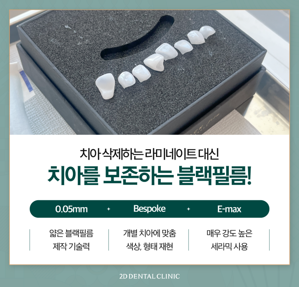 강남역치과 치아끝깨짐 첫인상을 좌우하는 요인! 관련 이미지 5