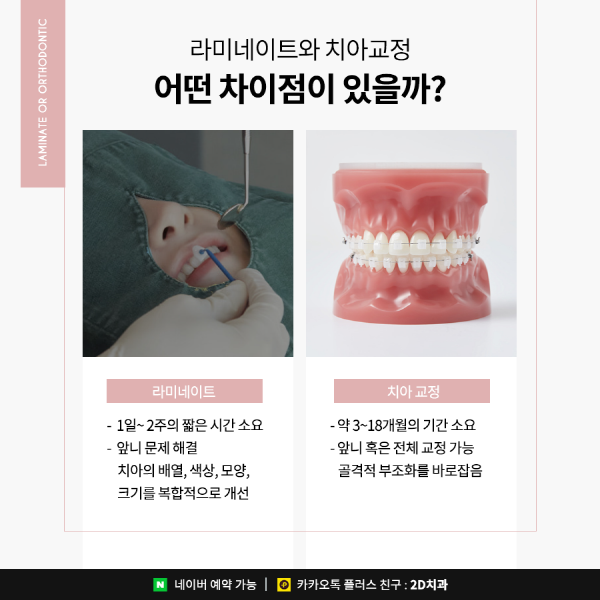벌어진앞니는 라미네이트? 치아교정? 이렇게 선택하세요 관련 이미지 3