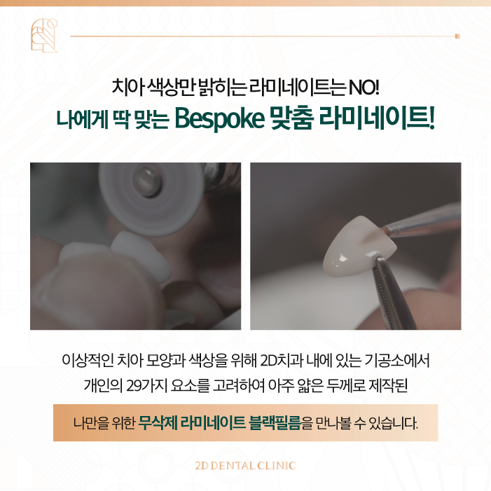 무삭제라미네이트비용 2D치과 변색치아를 하얗게! 관련 이미지 5
