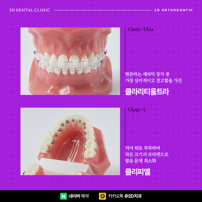 늦지 않은 40대치아교정, 강남 심미성, 기능성 높이는 치아교정 관련 이미지 4