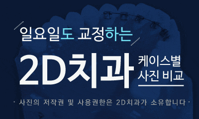 케이스로 확인하는 덧니 부정교합, 교정전문 2D치과 관련 이미지 3