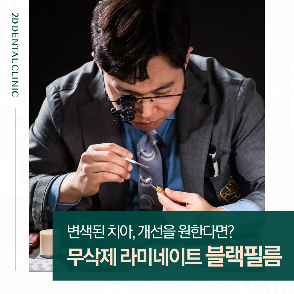 인천무삭제라미네이트 앞니치아변색 커피 먹고 누런 이 다시 하얗게 관련 이미지 1