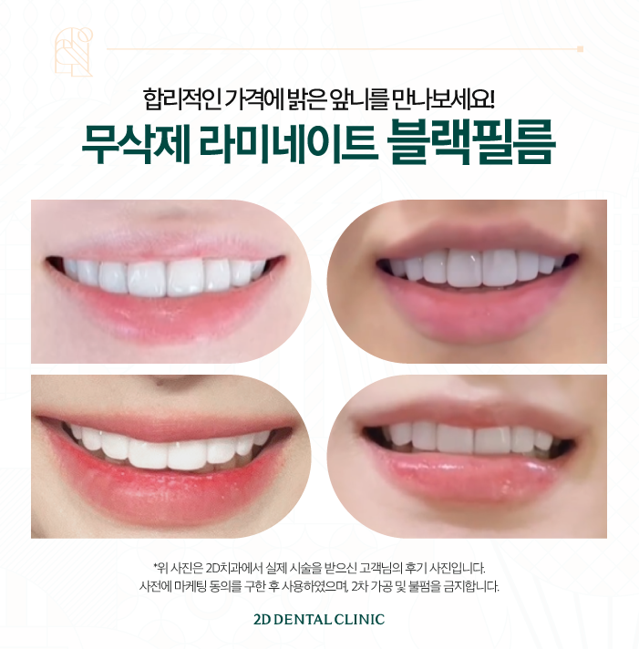 무삭제라미네이트후기 믿음이 가는 블랙필름 관련 이미지 6