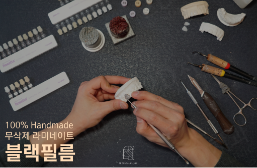 라미네이트 제거 해도 자연치아로 사용이 가능한 블랙필름 관련 이미지 3