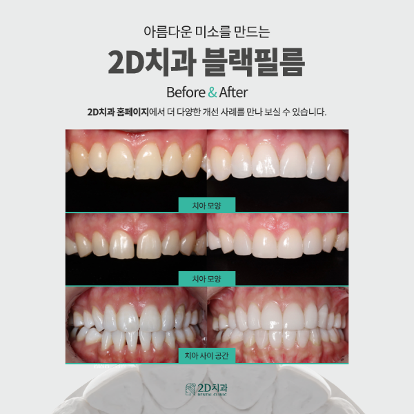 진짜 관련 이미지 7