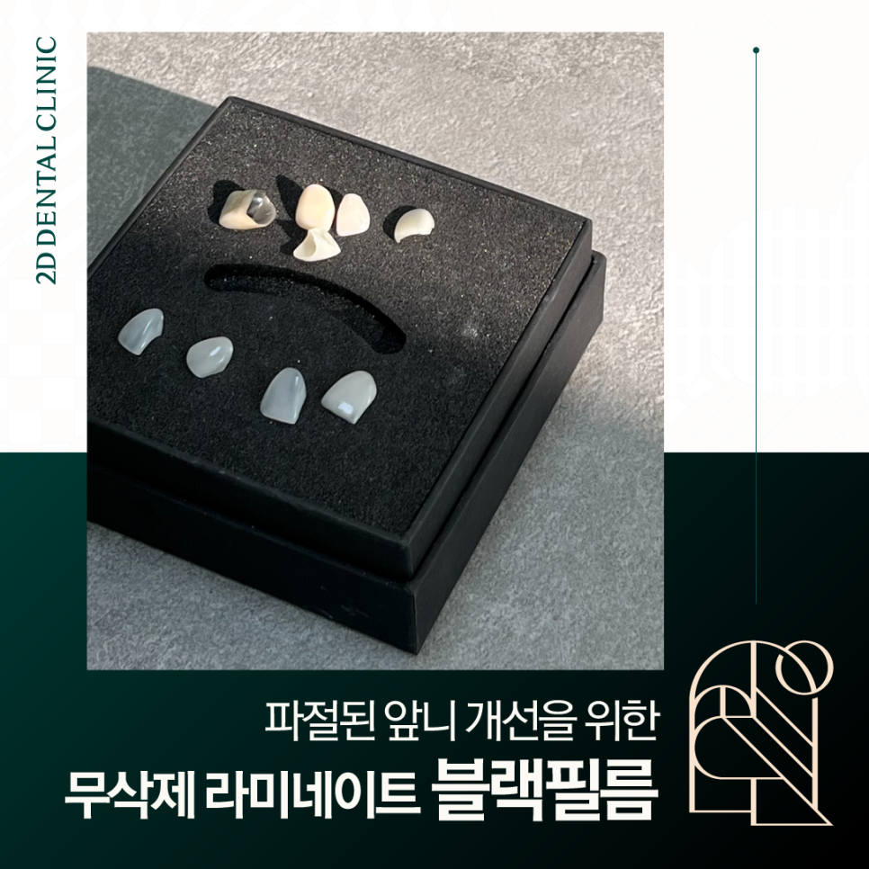 무삭제라미네이트가격 앞니파절 딱딱한 음식 먹다가 이가 부러졌다면 관련 이미지 1