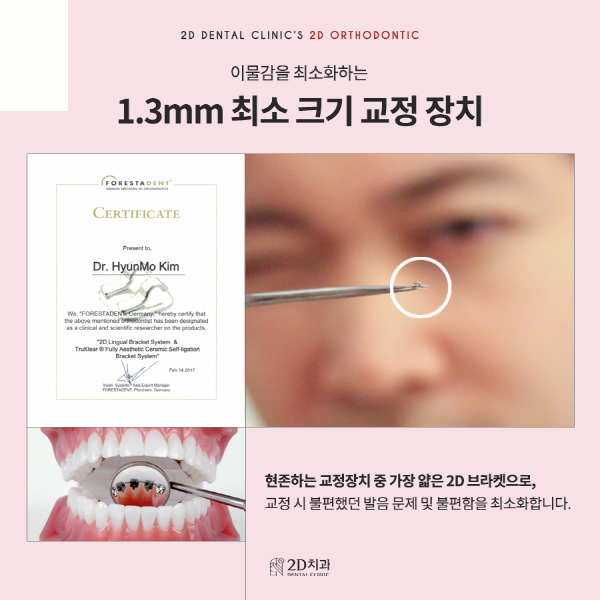 "아무도 모르게 예뻐지자" 티 안나는 <2D교정> 관련 이미지 5