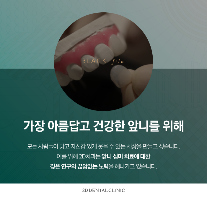 치아 무삭제 라미네이트 블랙필름 효과, 만족도는? 관련 이미지 10