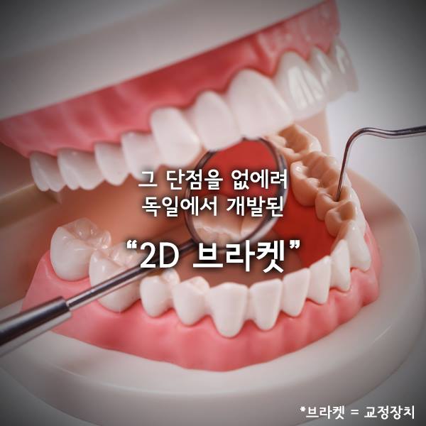 [투디(2D)치과] 2D교정에 대해 아시나요? 관련 이미지 3