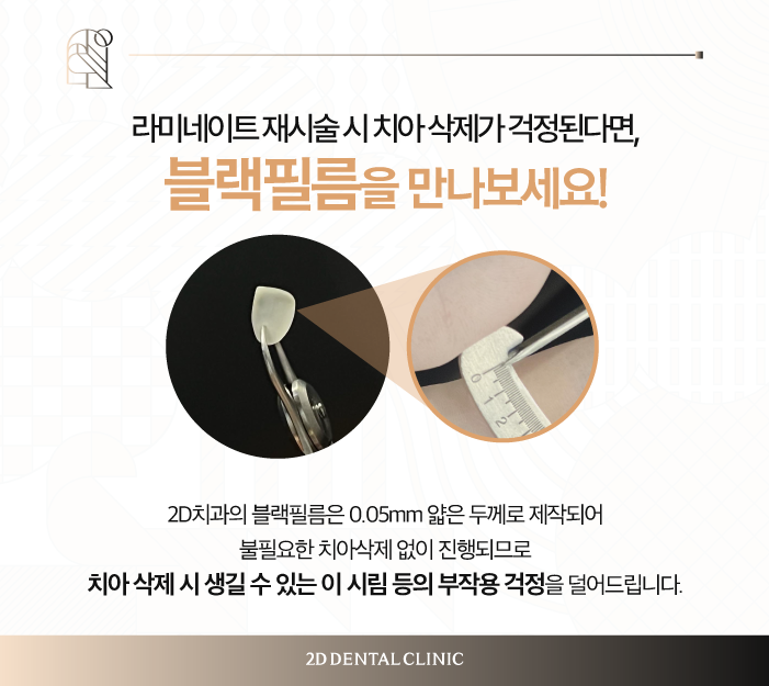 무삭제라미네이트비용 라미네이트 교체도 문제없어요 관련 이미지 4