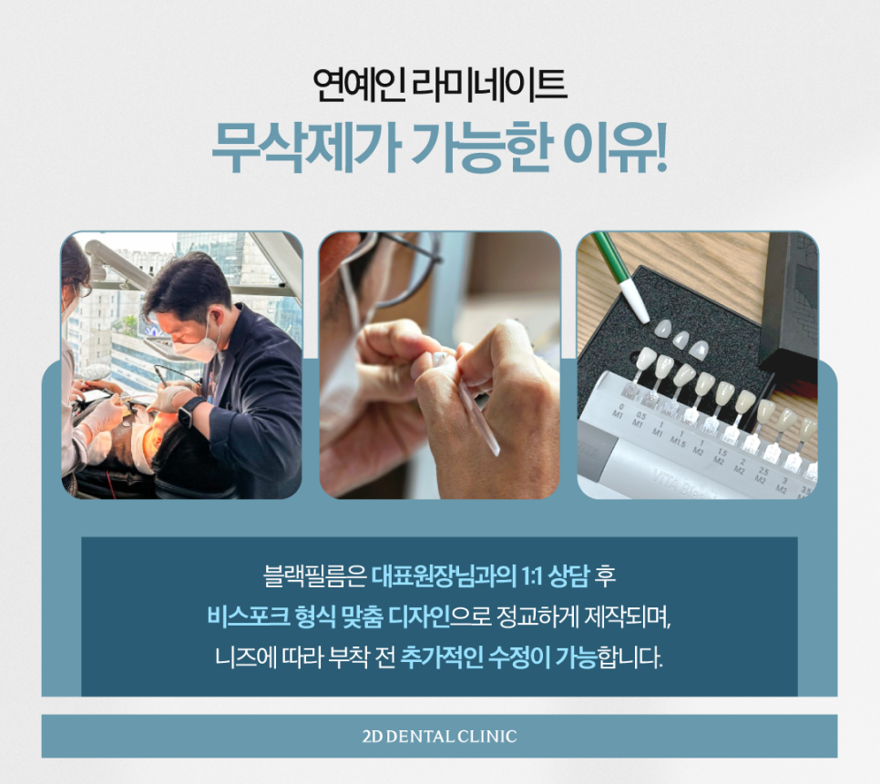 치과라미네이트 치아성형 이 손상 줄이고 심미성 높이고 관련 이미지 5
