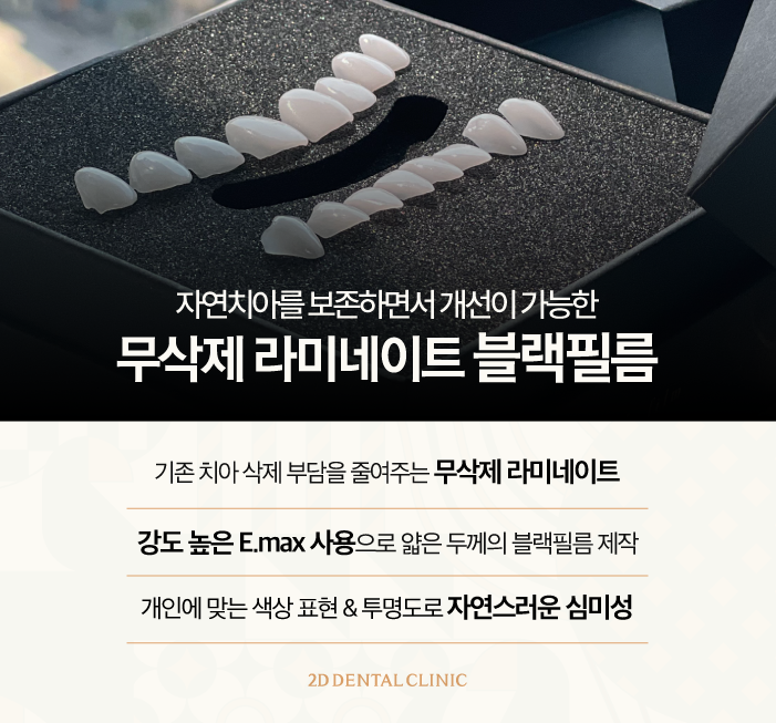 무삭제라미네이트후기 투디치과 블랙필름 탄생 과정 관련 이미지 3