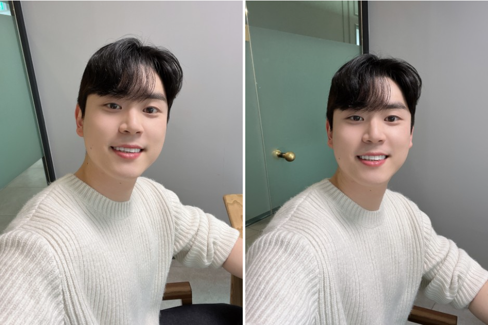 라미네이트치료 치아손상없는 무삭제라미네이트 블랙필름 관련 이미지 8