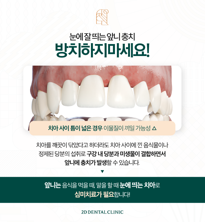 무삭제블랙필름 역삼동치과 앞니 충치 적합한 치료 방법은 관련 이미지 3