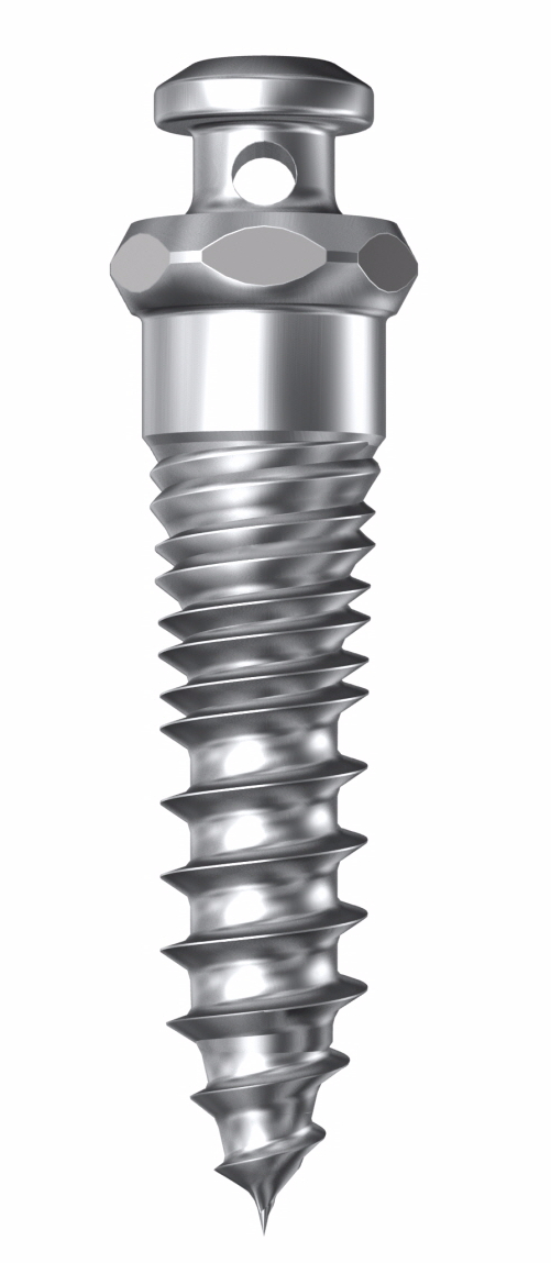 돌출입 유형 및 증상, 치과 내원 전 자가진단! 관련 이미지 10