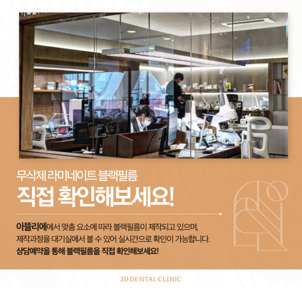 무삭제라미네이트비용 앞니성형 이렇게 결정됩니다 관련 이미지 5