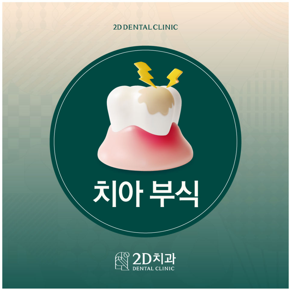 치아부식 내 이가 점점 약해지는 이유는? 관련 이미지 1