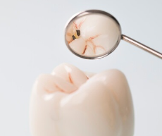 무삭제라미네이트부작용 블랙필름과 비교 관련 이미지 6