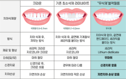 무삭제라미네이트부작용 블랙필름과 비교 관련 이미지 7