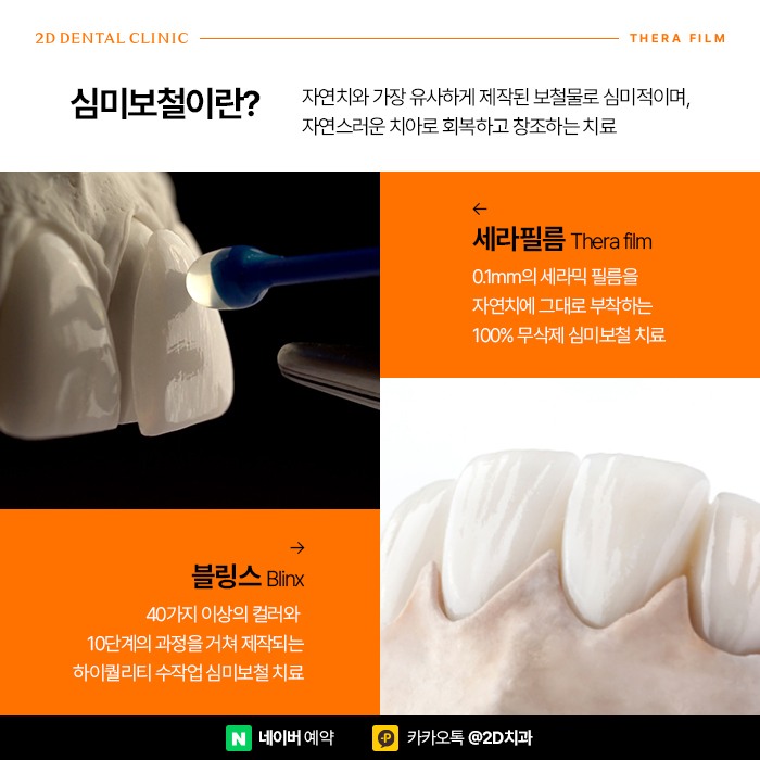 하얀치아로 면접 1분 자기소개 예시 임팩트 준비, 신논현 심미보철 관련 이미지 2