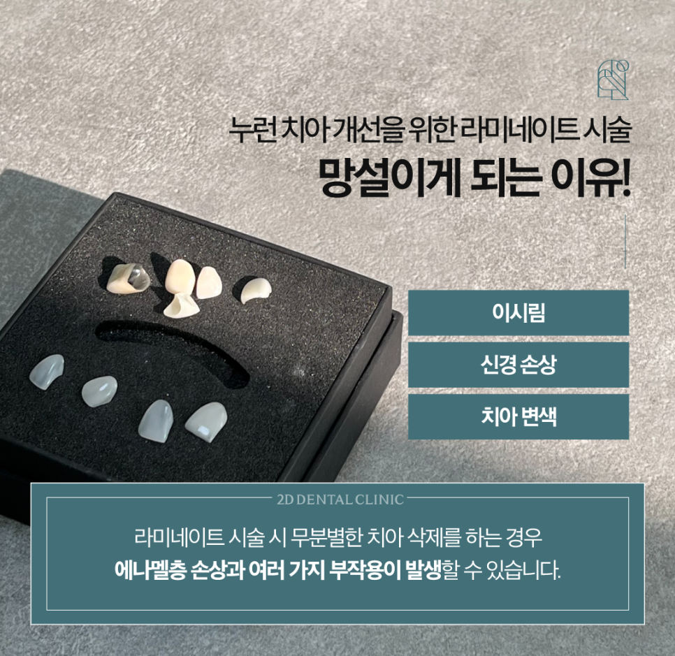 무삭제라미네이트부작용 치아미백치과 누런 이 치료, 망설여진다면 관련 이미지 3