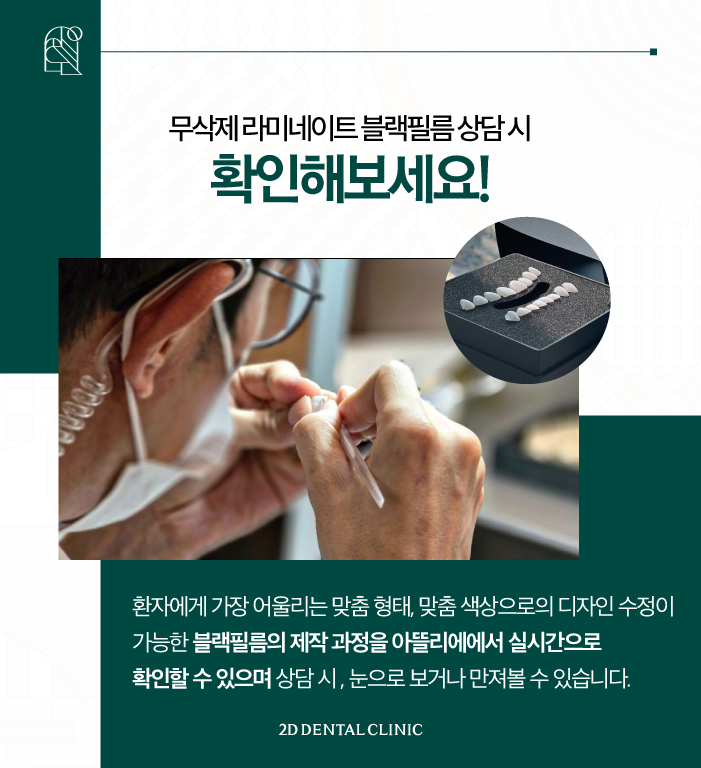 무삭제 라미네이트 블랙필름 제작은 어디서? 투디치과 아뜰리에! 관련 이미지 5